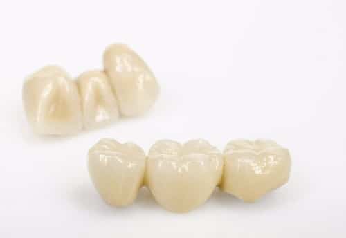 Dental Crown Considerations | Dental Crowns | Dentist in Buffalo, NY