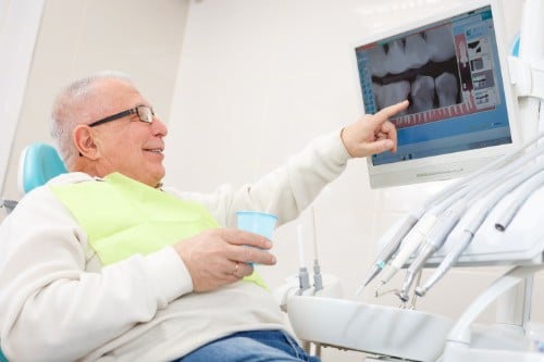 What to Know About Dentures