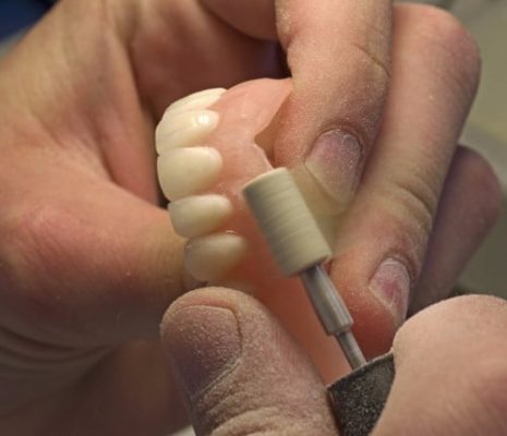 understanding dentures