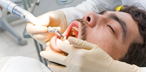 Composite Tooth Fillings in Buffalo Amherst Dentist Douglas Hamill DDS
