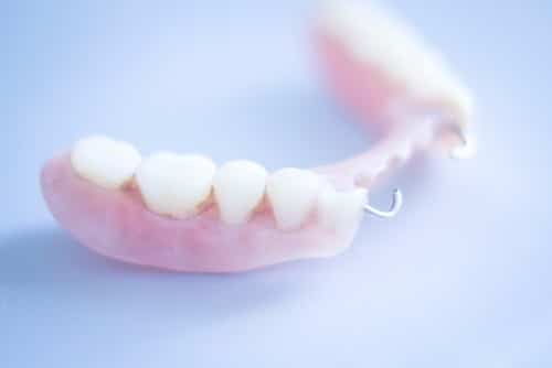 Partial Dentures Explained Buffalo Dentist Douglas Hamill DDS