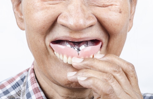 Affordable Dentures Buffalo, NY | Free Consultation | Douglas Hamill DDS