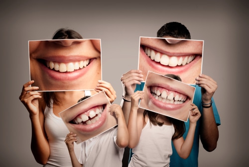 How to Achieve the Perfect Smile