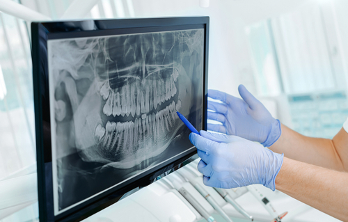 Dental Technology at Queen City Family Dentistry in Amherst, NY