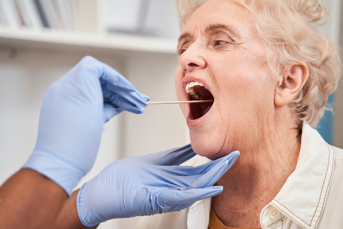 Oral Lesion Screening